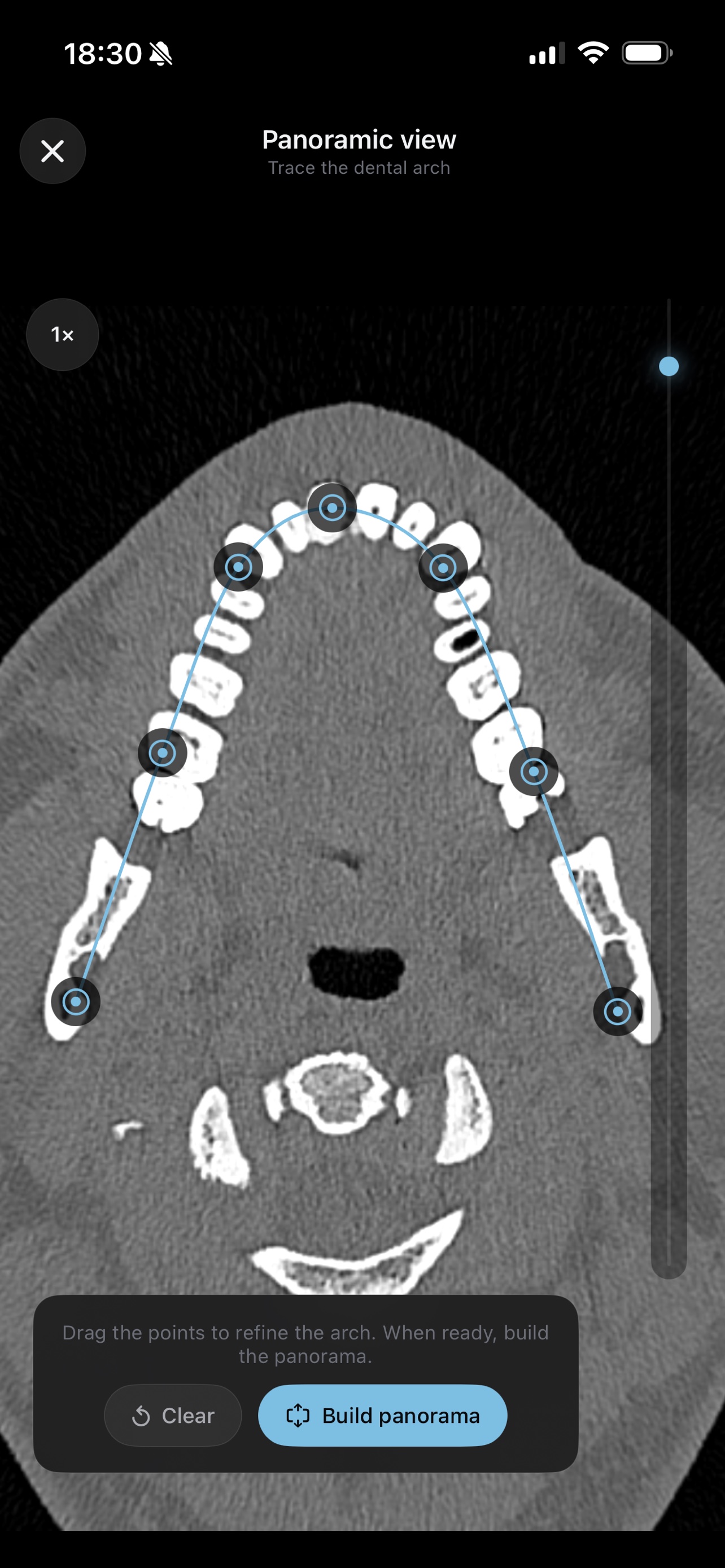 Panoramic view — tracing the dental arch on an axial CT slice