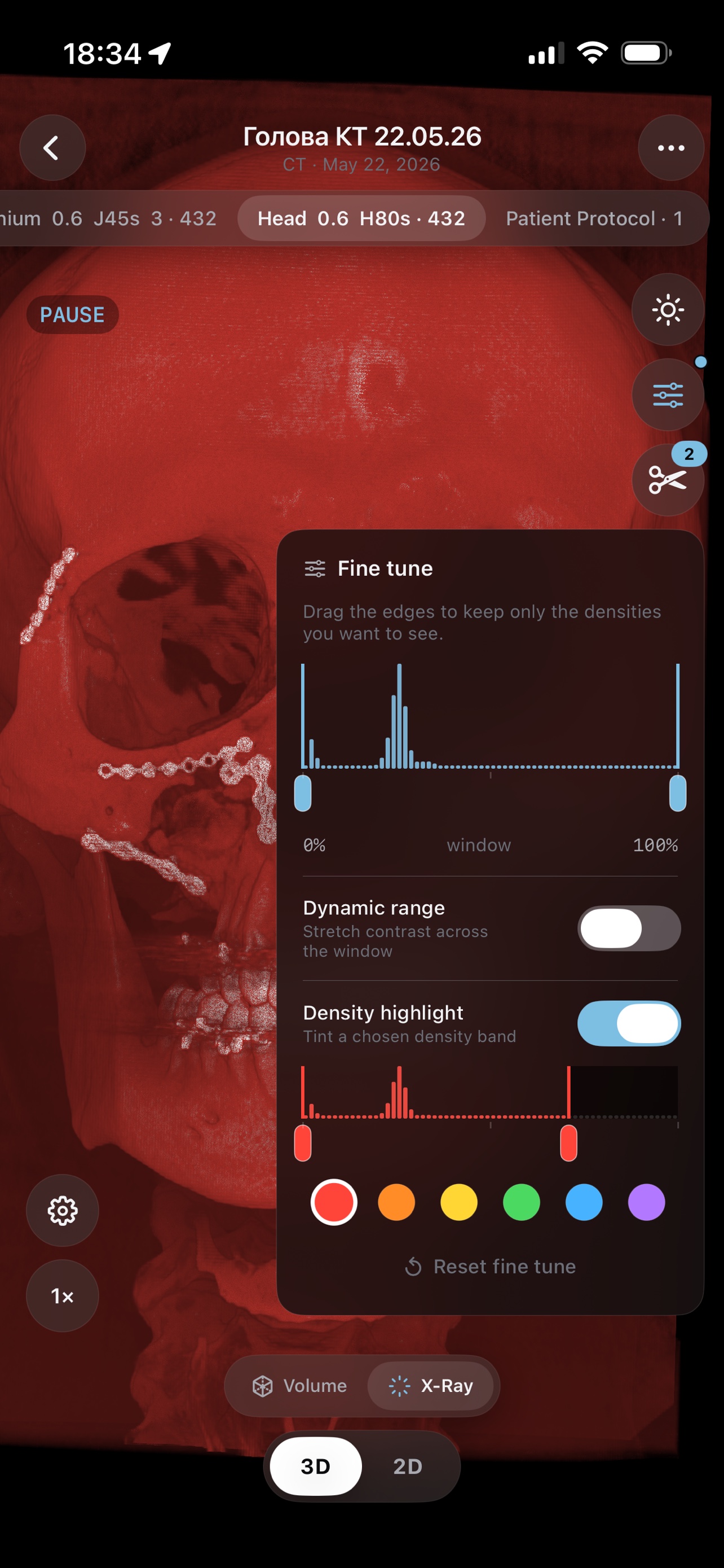 3D X-ray density render with fine-tune controls